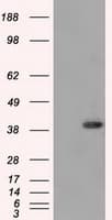 Monoclonal Mouse anti-Human DNTTIP1 / TDIF1 Antibody (clone OTI1F4, IHC, IF, WB)
