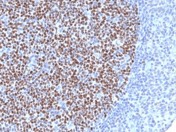 BCL6 Antibody (clone BCL6/1527)