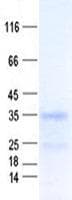 Human NUP37 Protein (Recombinant His, N-Terminal)