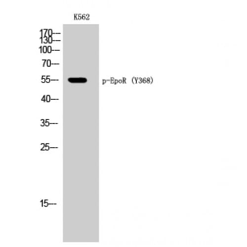 EPOR / EPO Receptor Antibody (phospho-Tyr368)