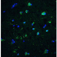 Polyclonal Rabbit anti-Human CD81 Antibody (IHC, IF, WB)