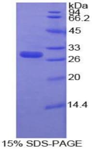 Human MMP16 Protein (Recombinant His-T7)