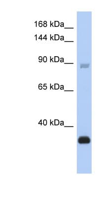 BCL11B Antibody (aa395-444)