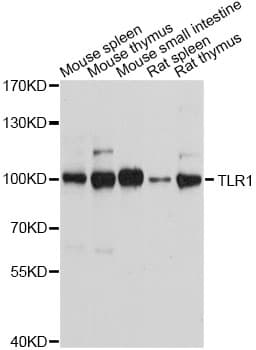 Polyclonal Rabbit anti-Human TLR1 Antibody (IHC, IF, WB)