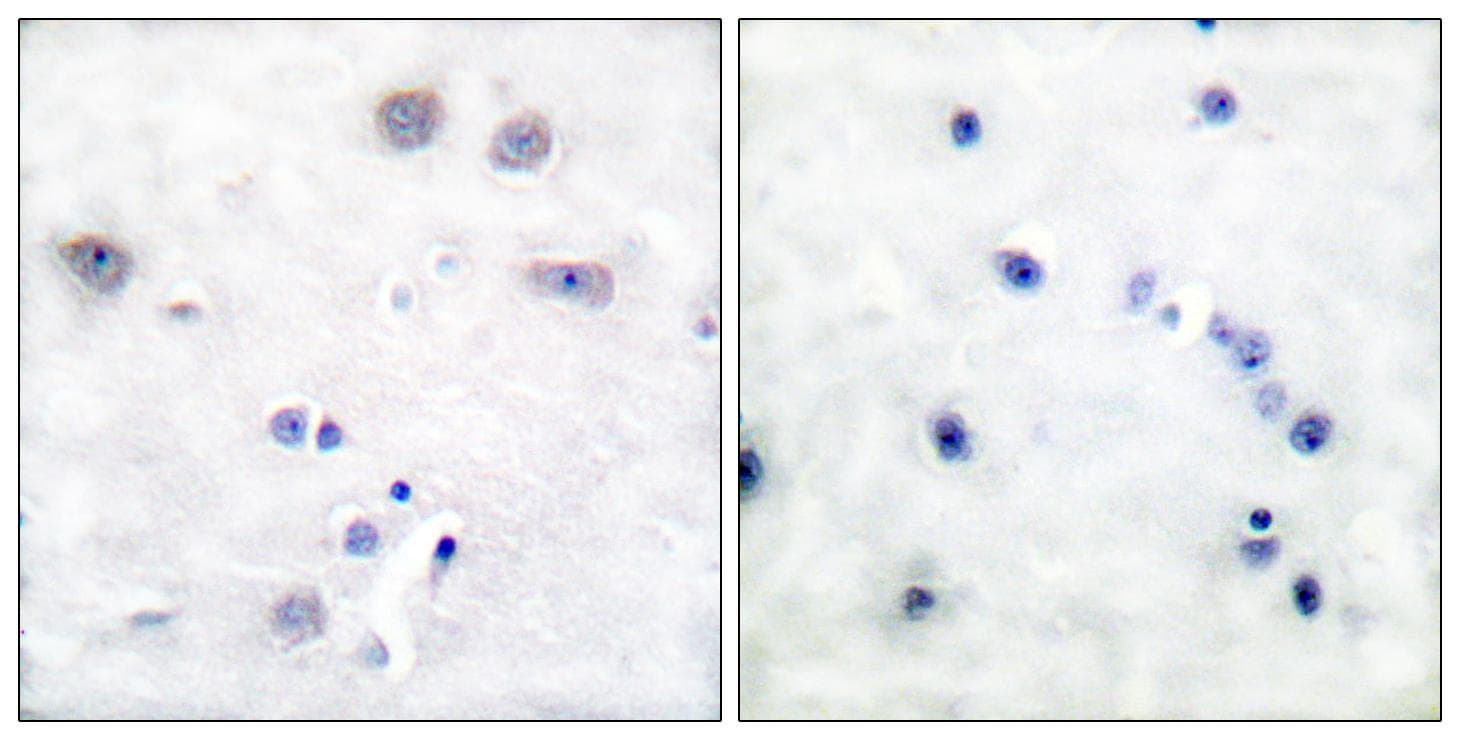 Polyclonal Rabbit anti-Human p66 / SHC Antibody (p427, IHC, WB)