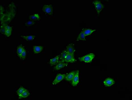 MLYCD / MCD Antibody