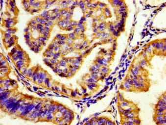 Polyclonal Rabbit anti-Human HTR7 / 5HT7 Receptor Antibody (IHC)