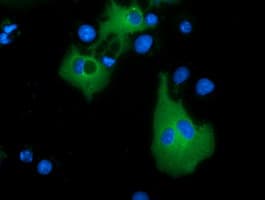 MTMR14 Antibody (clone OTI7F2)