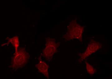 TGFB1 / TGF Beta 1 Antibody