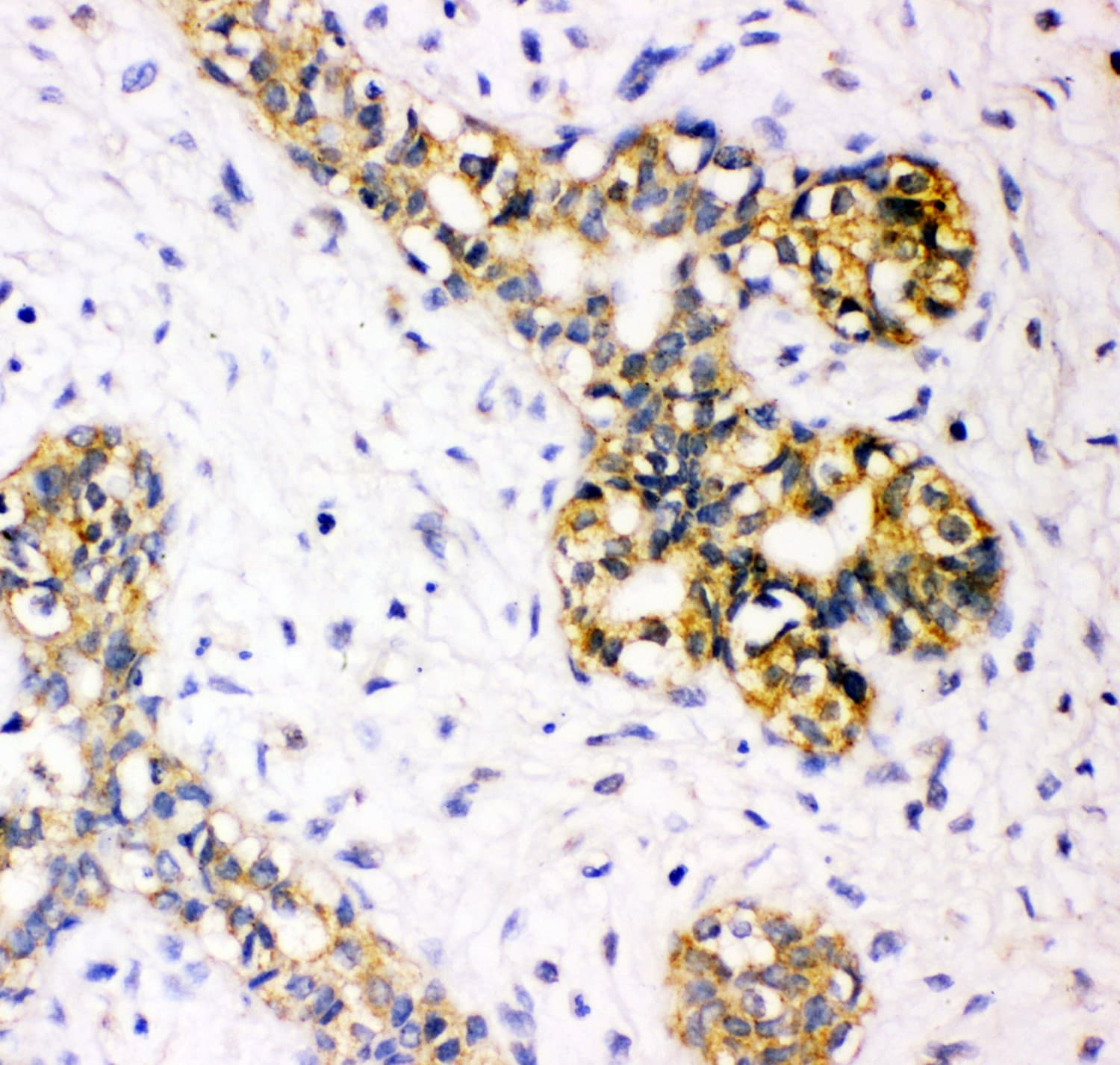 Tuberin / TSC2 Antibody (aa1611-1807)