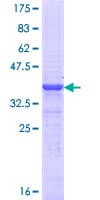Human POU4F1 / BRN3A Protein (Recombinant GST, N-terminus)