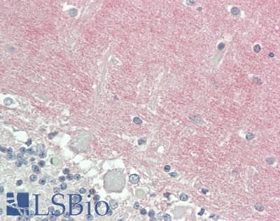 VCAN / Versican Antibody (aa2958-3209)