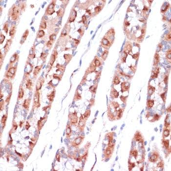 Polyclonal Rabbit anti-Human UBE2O Antibody (IHC)