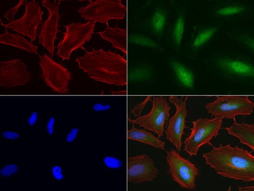 C14orf166 Antibody (clone UMAB175)