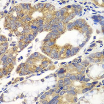 PFKM / PFK-1 Antibody