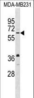 Polyclonal Rabbit anti-Human NSMF / NELF Antibody (aa501-530, WB)