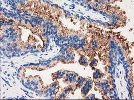 ANXA3 / Annexin A3 Antibody (clone OTI5G4)