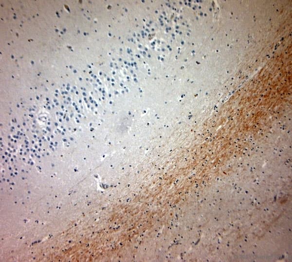 Polyclonal Rabbit anti-Human MBP / Maltose Binding Protein Antibody (aa180-220, IHC)