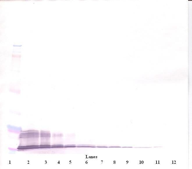 IHC-plus™ Polyclonal Rabbit anti-Human CXCL11 Antibody (IHC, WB)