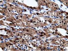 EPHX2 / Epoxide Hydrolase 2 Antibody (clone OTI1H5)