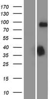 DCLK / DCLK1 Protein (Over-Expression Lysate Myc-DDK (Flag))