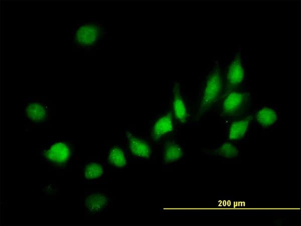 ATOX1 Antibody (clone 2E6)