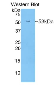 Polyclonal Rabbit anti-Mouse ABCB1 / MDR1 / P Glycoprotein Antibody (Biotin, aa81-321, WB)