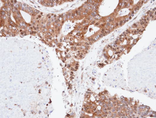 Polyclonal Rabbit anti-Human SPFH2 / ERLIN2 Antibody (aa278-339, IHC, WB)