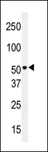 Polyclonal Rabbit anti-Human SLC29A4 Antibody (aa39-69, IHC, WB)