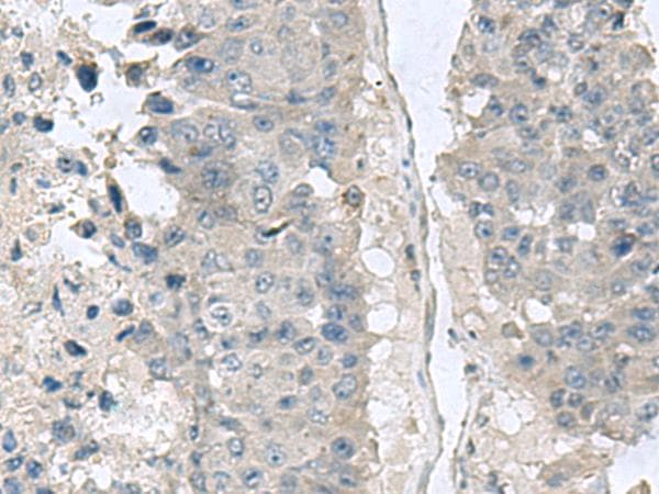 Polyclonal Rabbit anti-Human NPHP1 / Nephronophthisis Antibody (IHC, WB)