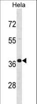 PABPN1 / PABP2 Antibody (aa270-298)