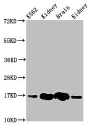 HBG2 / Hemoglobin Gamma 2 Antibody