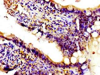 PIK3CA / PI3K Alpha Antibody