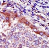 Polyclonal Rabbit anti-Human HUNK / B19 Antibody (aa659-690, IHC, WB)