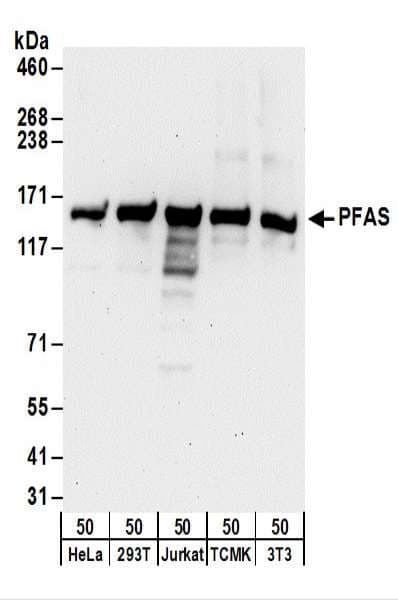 Polyclonal Rabbit anti-Human PFAS Antibody (aa875-925, WB)