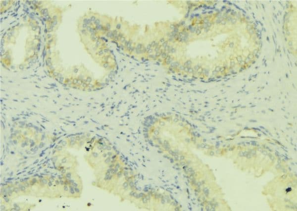 Polyclonal Rabbit anti-Human WASF1 / WAVE Antibody (IHC, IF, WB)
