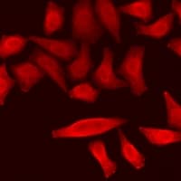 RPS6KL1 Antibody