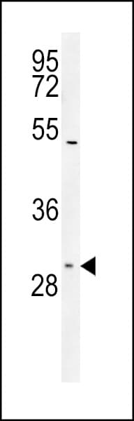 SLC25A1 / SEA Antibody (aa142-170)