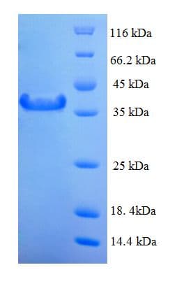 Human MAD2L1 / MAD2 Protein (Recombinant His-SUMO)