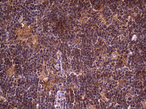 DOCK8 Antibody (aa832-1160, clone OTI4H10)