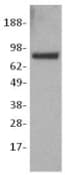 CTNNB1 / Beta Catenin Antibody (clone 15B8)