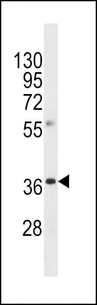 Polyclonal Rabbit anti-Human OR8A1 Antibody (aa10-39, WB)