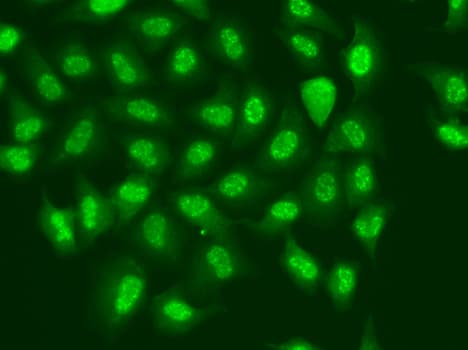 RPB16 / POLR2D Antibody