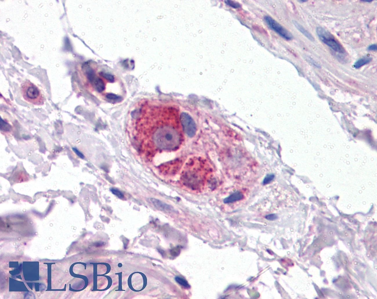 IHC-plus™ CYP26B1 Antibody (aa418-430)
