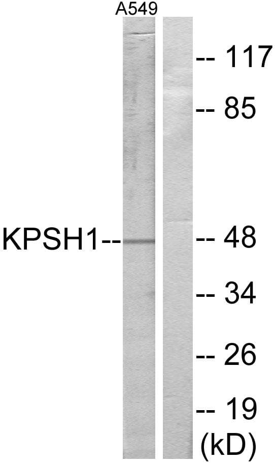 PSKH1 Antibody