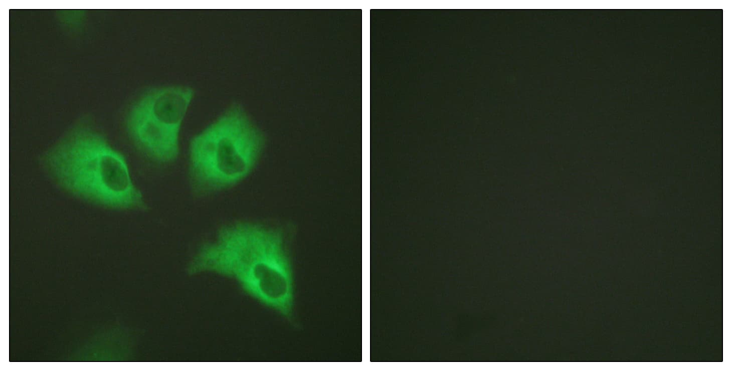 Polyclonal Rabbit anti-Mouse KCNJ16 / Kir5.1 Antibody (phospho-Ser417, IHC, IF, WB)