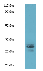 Polyclonal Rabbit anti-Human ATF1 Antibody (aa1-210, IHC, WB)