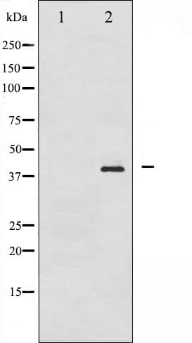 NPM1 / NPM / Nucleophosmin Antibody (phospho-Thr199)