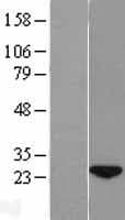 WDYHV1 Protein (Over-Expression Lysate Myc-DDK (Flag))