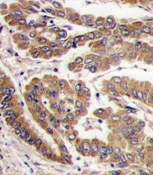 PRKCZ / PKC-Zeta Antibody (aa166-197)